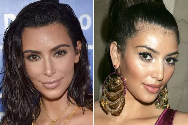 Kim Kardashian before and after Plastic Surgery Journey